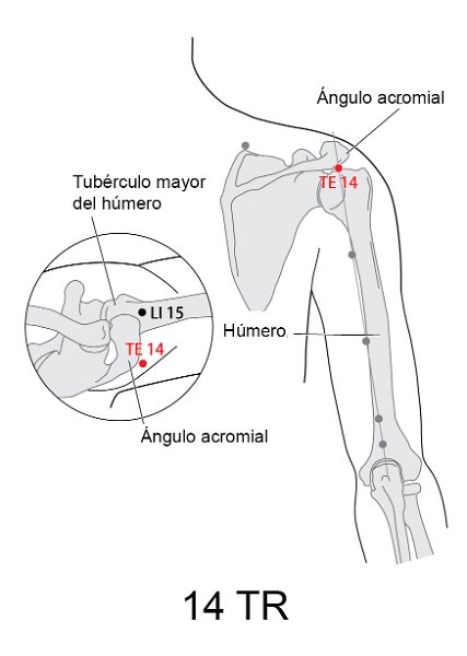 TR14