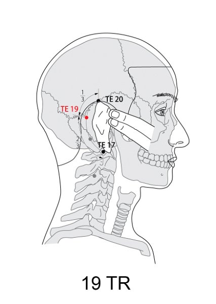 TR19